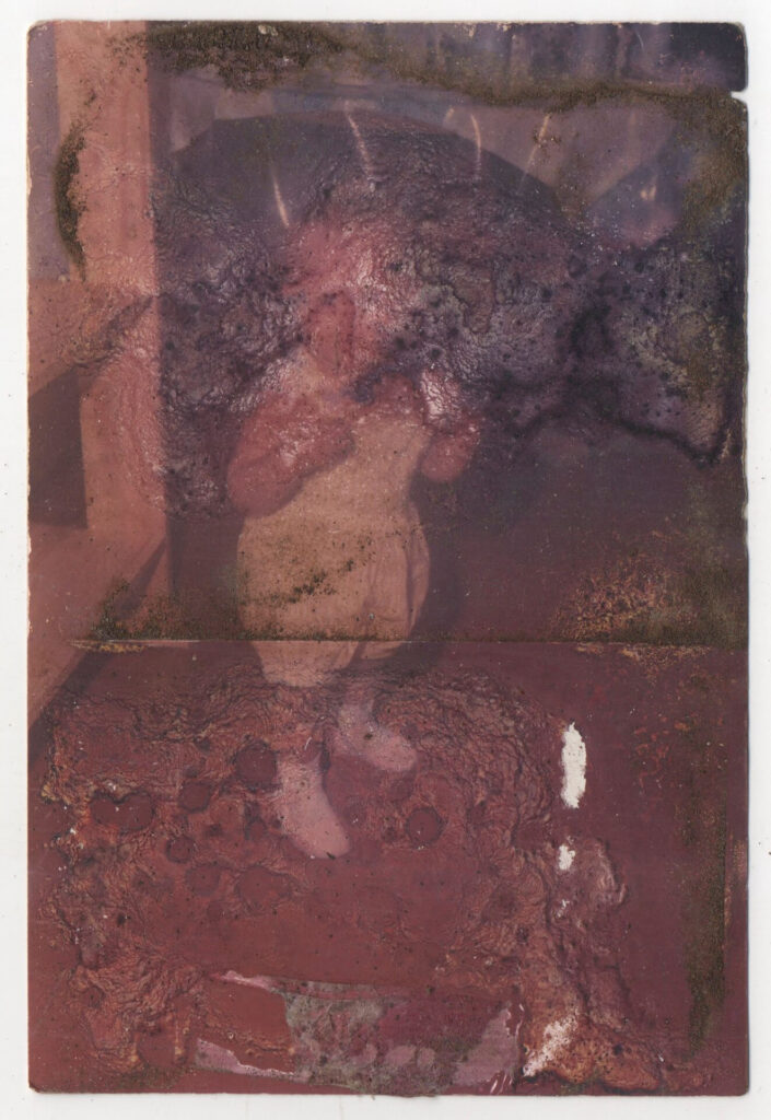 Fotografia retangular vertical de papel fotográfico mofado e embolorado, com manchas escuras no topo e na base. Elas encobrem o rosto de uma criança pequena em pé, com os braços dobrados à frente. Ela usa um macacão de mangas curtas amarelo claro até os joelhos, meias e sapatos brancos. A foto é contornada por uma borda estreita branca. Roteiro de audiodescrição: Adamy. Consultoria: Ednilson Sacramento.